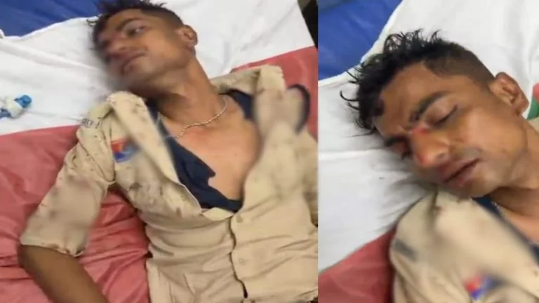 Crime News: डायल-112 के आरक्षक पर जानलेवा हमला, शराब के नशे में सिरफिरे ने डंडे से वार कर किया घायल